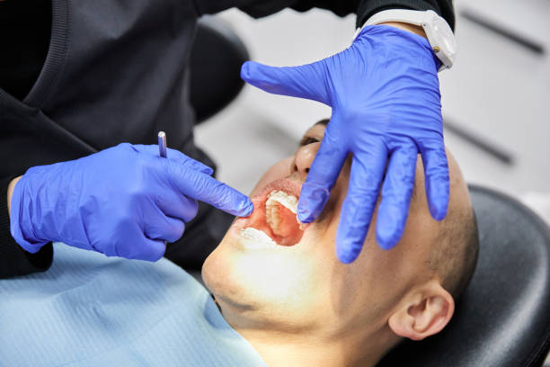 Best Same-Day Emergency Dental Services in Clarendon, TX